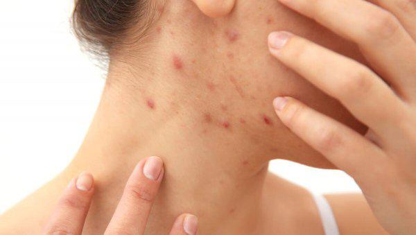 如何赶走耳边的蚊子