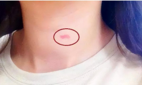 男生吸草莓的真正原因