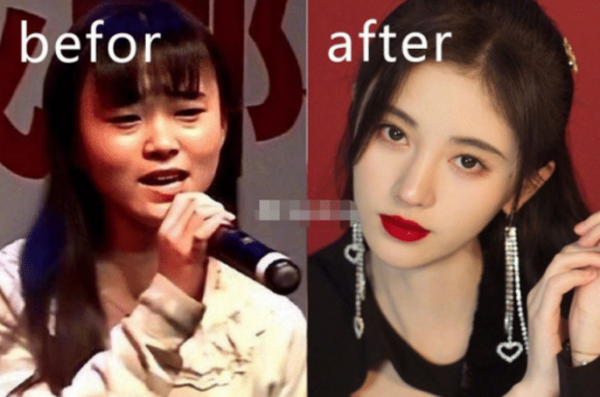 鞠婧祎做过容吗