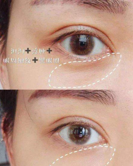 紫熨斗和雅诗兰黛眼霜哪个好用