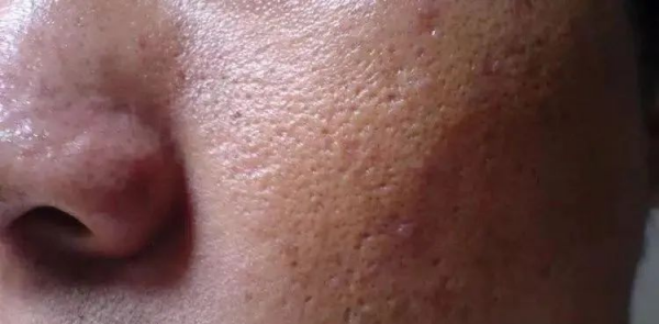 护肤品搓泥是什么原因