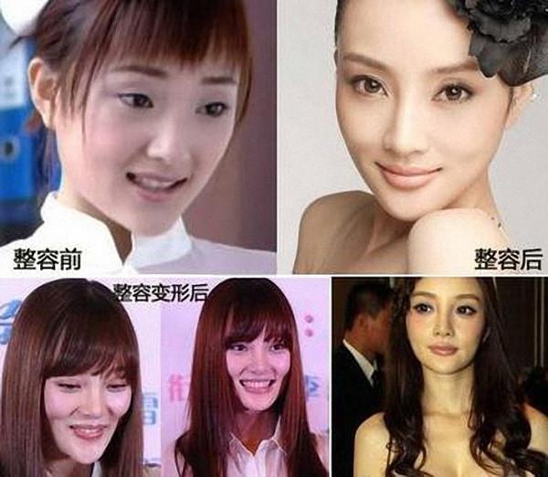 有酒窝的女明星都是谁(