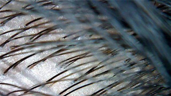 染一次头发得多久排毒