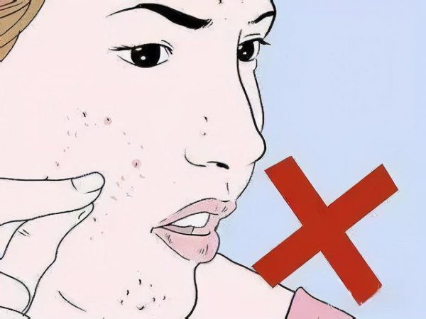 脸上挤出硬粒是螨虫吗