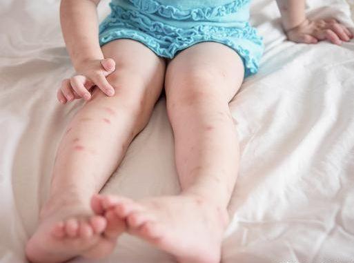 一开灯蚊子就不见了去哪了