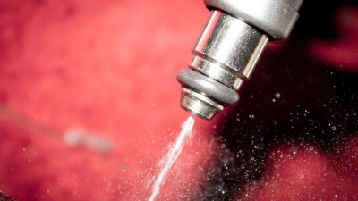 喷油嘴清洗有必要吗 发动机喷油嘴多久清洗一次合适