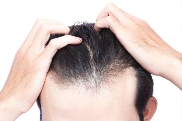 不用洗头膏洗头有什么好处