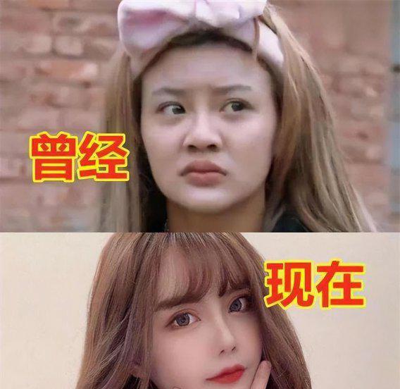 韩安冉整容前后对比照片