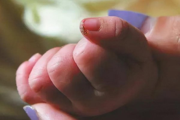 晚上能剪指甲吗