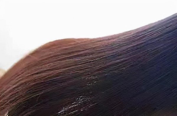 白醋洗头发的正确方法和用量