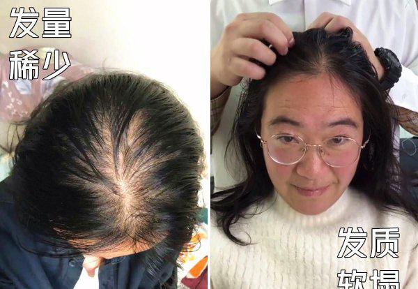 中年女性短发发型显年轻