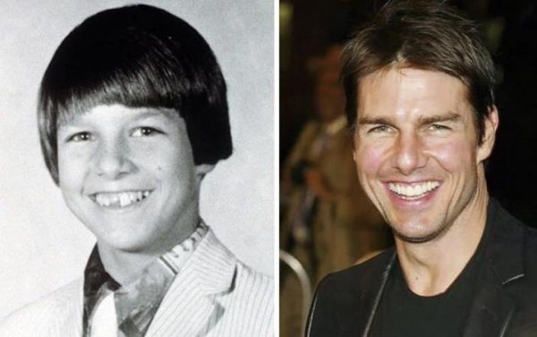 妮可基德曼和阿汤哥为什么分手