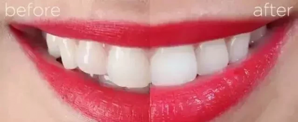 美白牙膏排名前十名