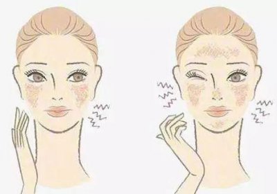 新手刷酸正确的护肤步骤 第一次自用刷酸指南教程