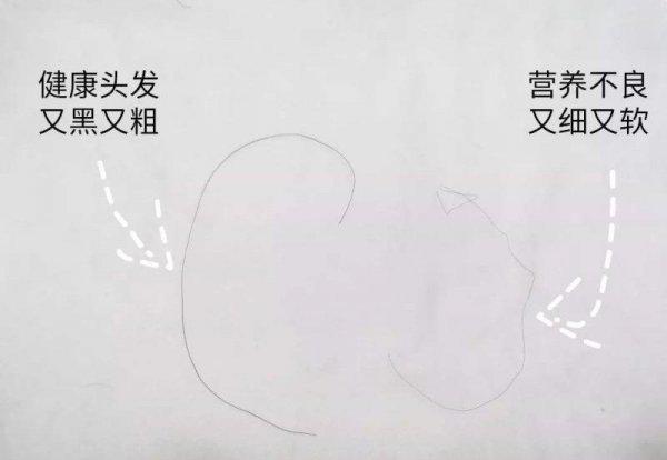 头发软又细又少怎么办