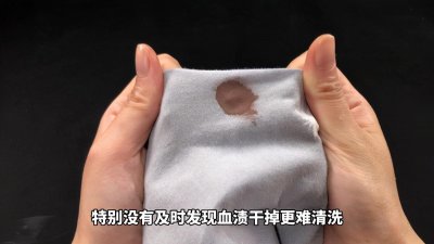 衣服上的血渍用什么洗可以洗掉 去除陈旧血渍的小妙招