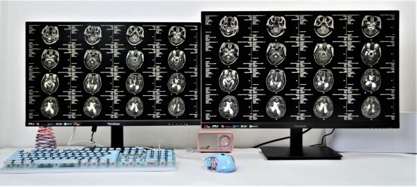 27寸屏和24寸图片对比如何