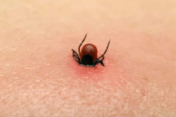 狗身上蜱虫会跑到人身上吗