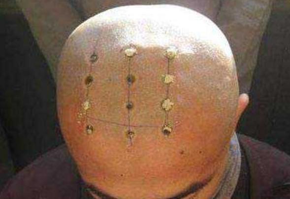 和尚头上的点代表什么意思