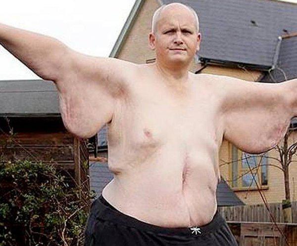 世界上最胖的人是谁.