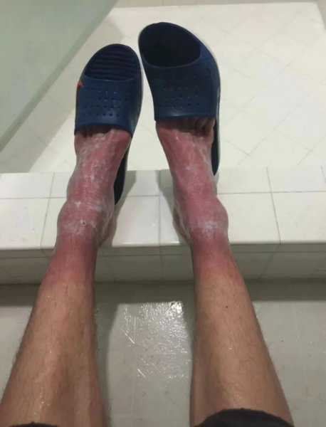 张国伟龙吸水视频