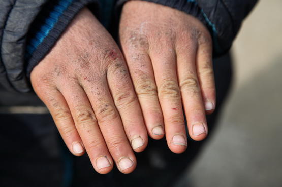 冻死的人为什么是笑脸