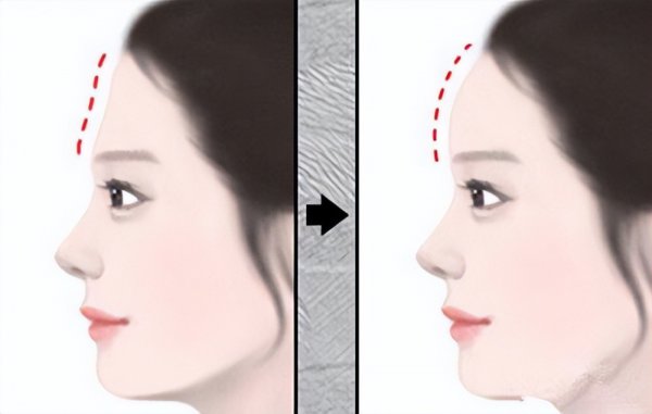 刘海怎么剪好看