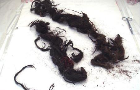 光绪帝死因是什么