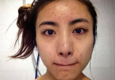 睡醒后脸上出油是好还是坏 睡醒后脸上出油很厉害什么原因