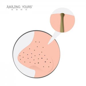 黑头贴多久用一次 五种去除黑头最有效的方法推荐