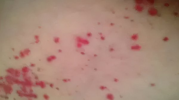 身上有红点是怎么回事