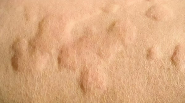 身上有红点是怎么回事