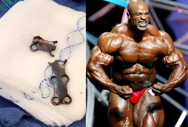 罗尼·库尔曼的健身秘诀