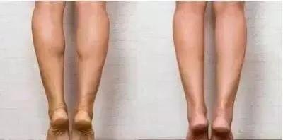 吴昕的腿是怎么瘦的