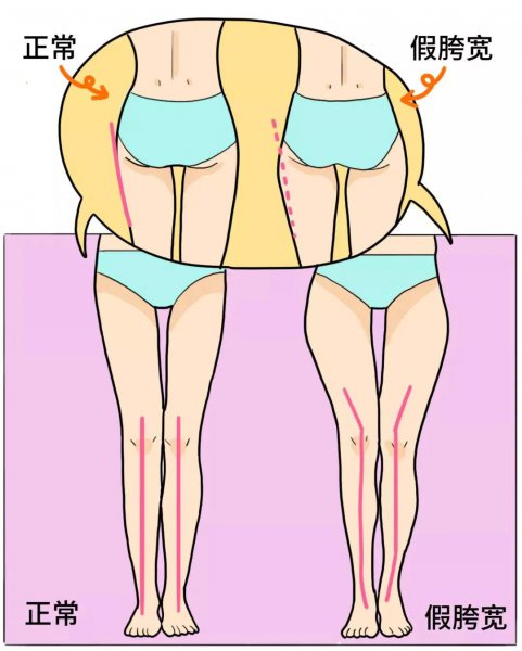 吴昕的腿是怎么瘦的