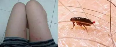 家里放一物绝对没跳蚤 发现家里有跳蚤应该怎么做