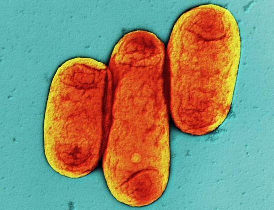 世界十大瘟疫分别为