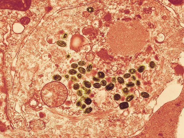 世界十大瘟疫分别为