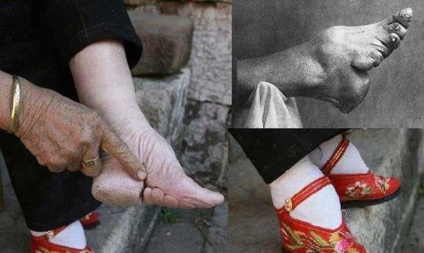 三寸金莲是多少厘米