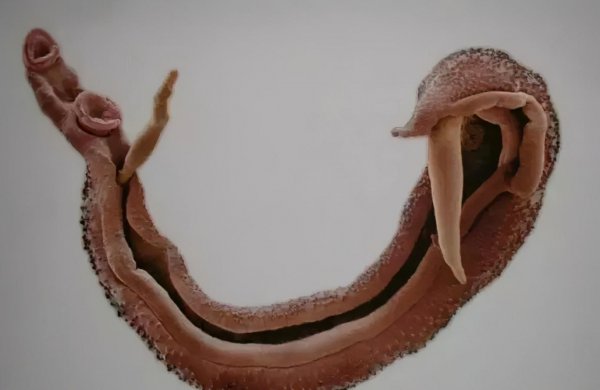 钉螺是淡水还是海水