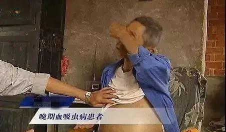 钉螺是淡水还是海水