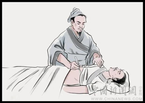 麻沸散问世于哪个朝代