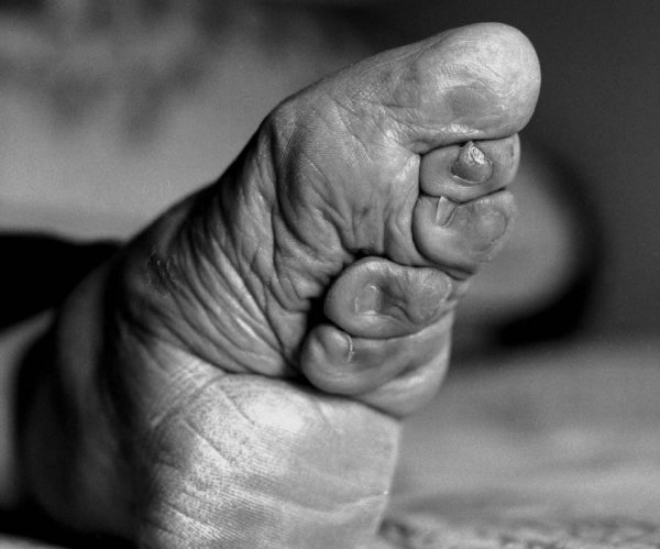 裹小脚的历史和起源