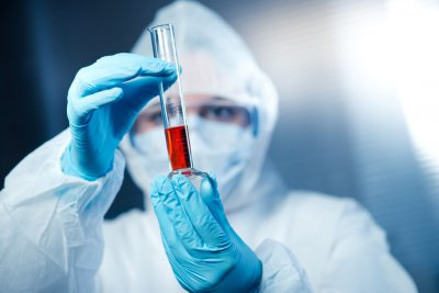 世界上最厉害的病毒 埃博拉病毒为何被称作最强病毒