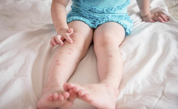 蚊子喜欢什么血型