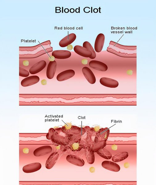 咬舌自尽真的能死吗