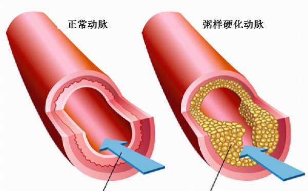 咬舌自尽真的能死吗
