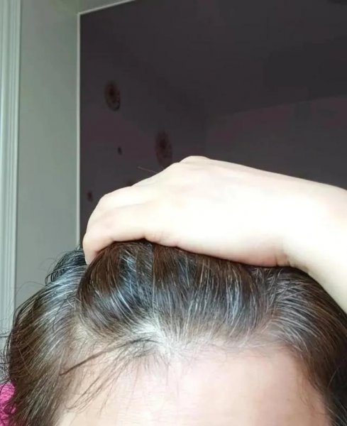 为什么染发白头发盖不住