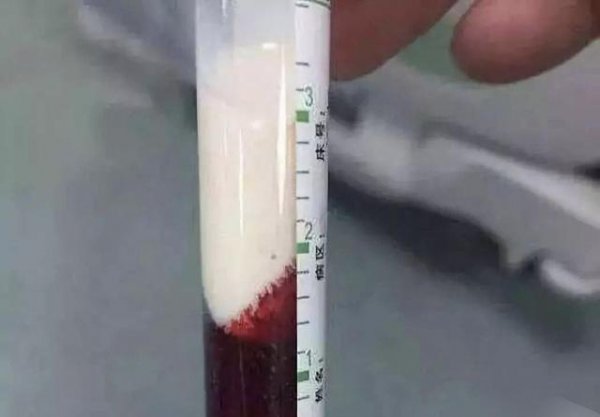 世界上最毒的蛇是哪种蛇