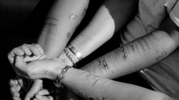 一个人多久不睡觉会死亡